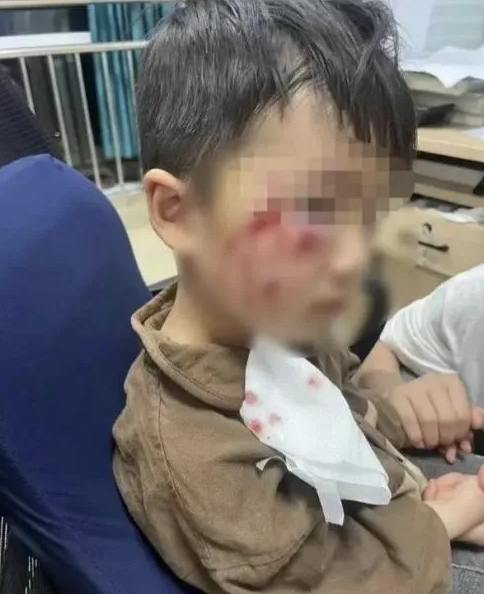 被瘋?cè)麤](méi)有“救命藥”，怎么辦？